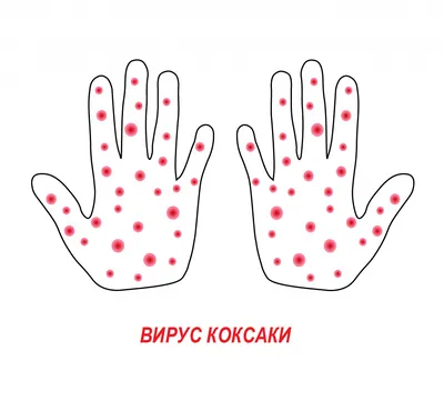 Руки с высыпаниями: изображения для диагностики экземы