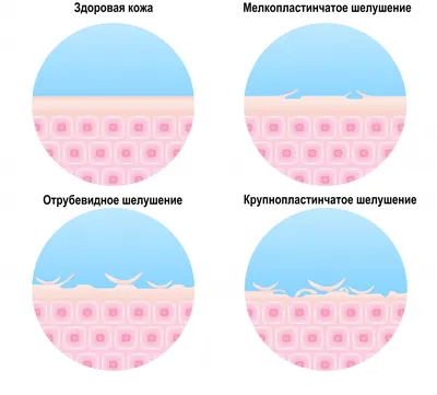 Изображения высыпаний на руках: как лечить герпес