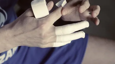 Вывих пальца руки: фотография на медицинском осмотре