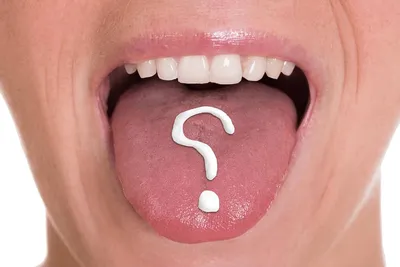 Ожоги слизистой полости рта - лечение термических ожогов языка, полости рта