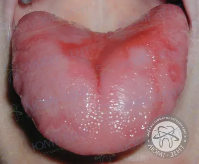 Лечение заболеваний полости рта в Москве — цены в клинике «Зубная Формула»