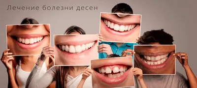 Что делать при появлении молочницы во рту | Стоматология Smile-at-Once |  Дзен