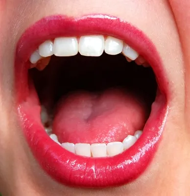 Заболевания полости рта: какие бывают, как лечат и проводят профилактику