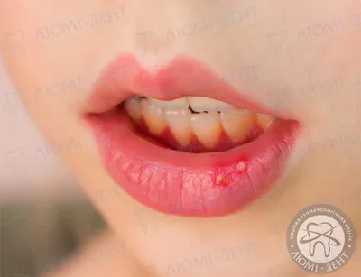 5 заболеваний организма, которые портят зубы. Стоматологи рассказывают, что  делать | Стоматология Smile-at-Once | Дзен