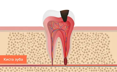 Гигиена полости рта: чистка зубов как залог здоровья | 15.03.2023 | Нягань  - БезФормата