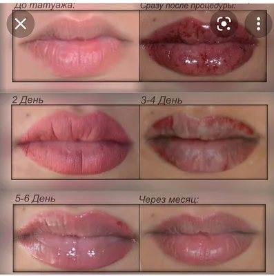 Изображение процесса заживления губ после татуажа