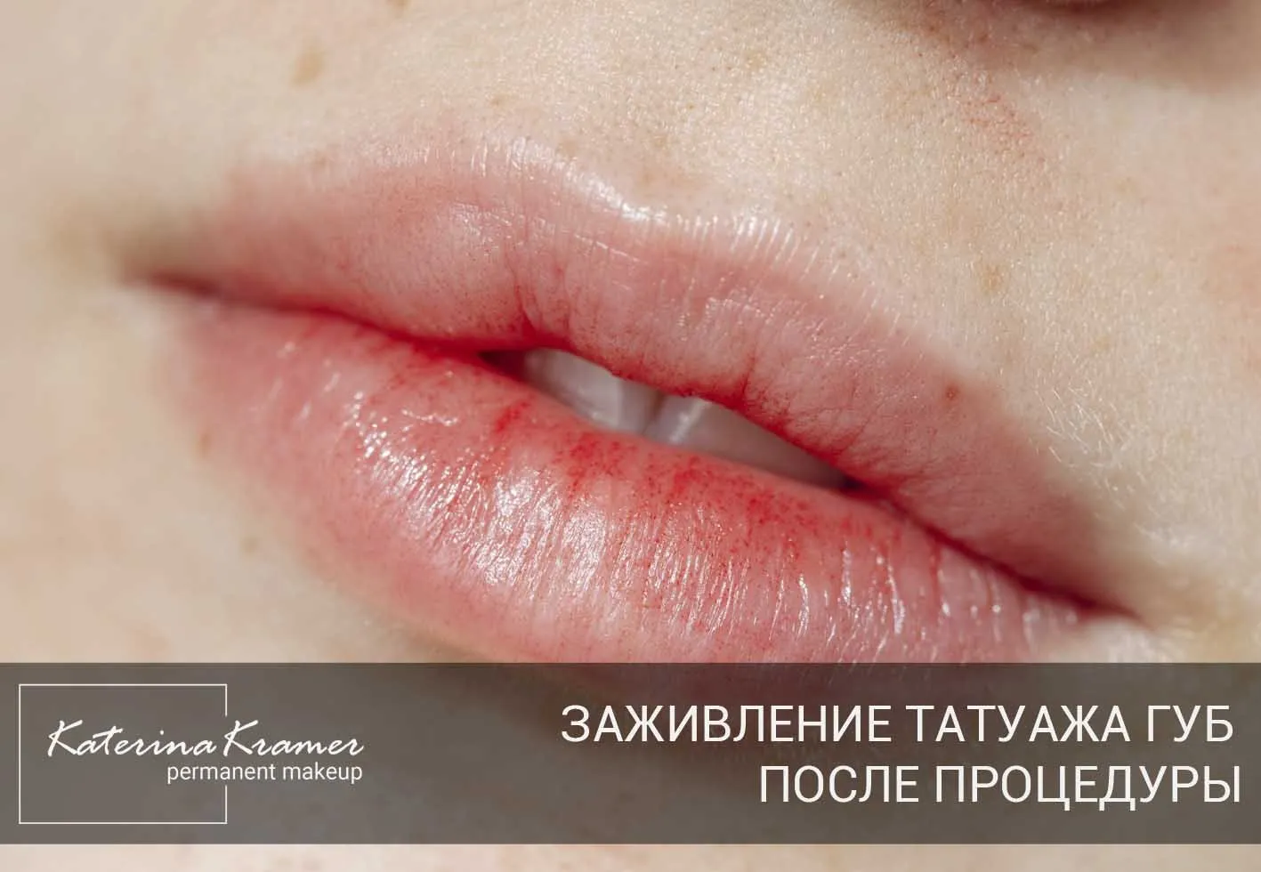 Процесс заживления перманентного макияжа губ фото