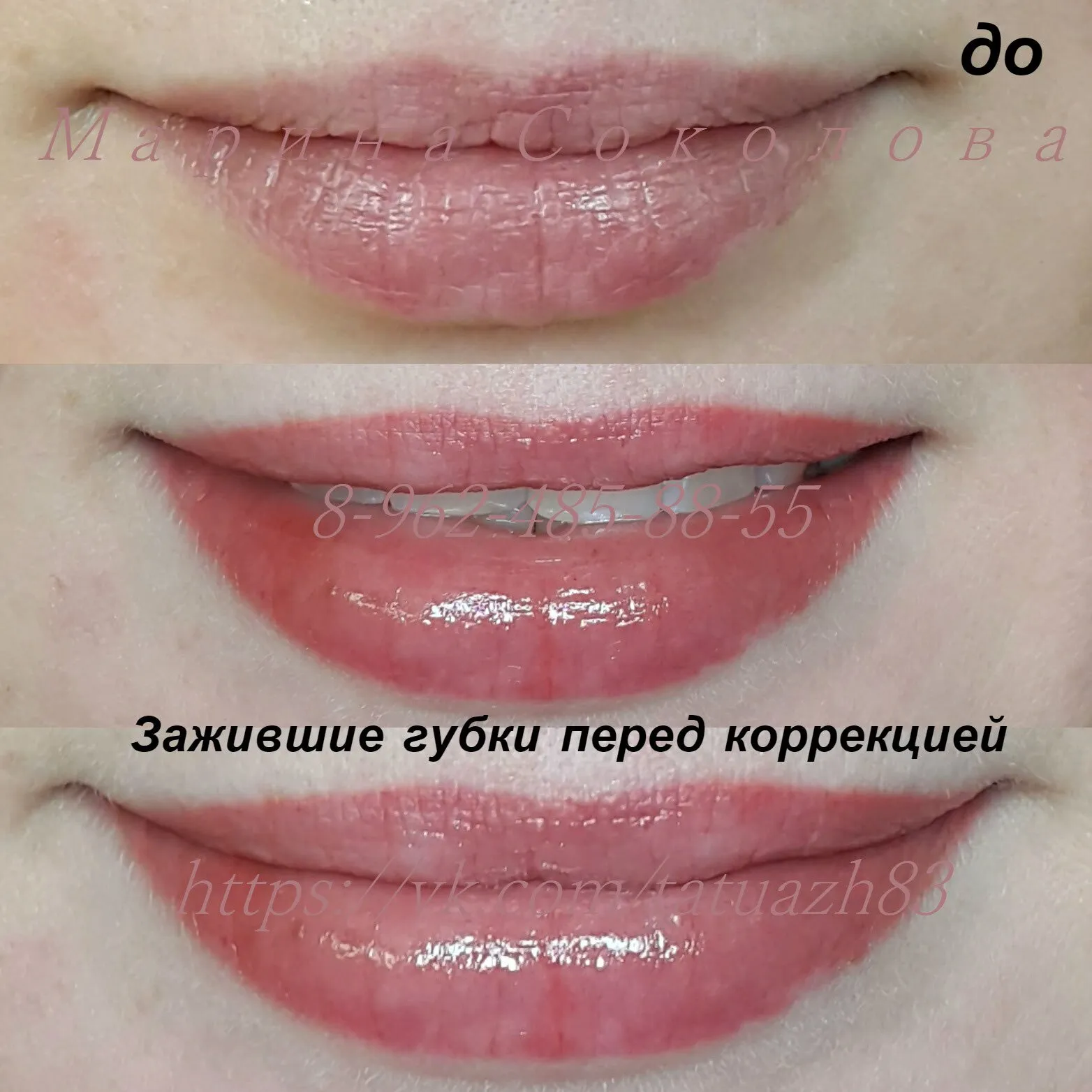 Заживление перманентного макияжа губ по дням фото