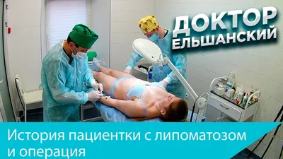 Фотография руки с жировиком в креативной обработке