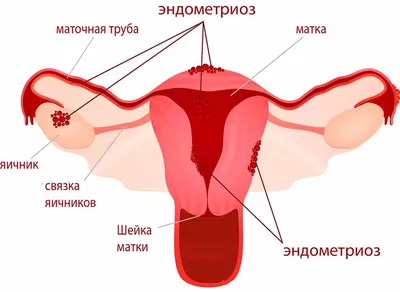 ProHealth Иглы инъекционные медицинские 30G - 20 шт