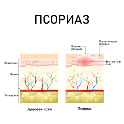 День профилактики инфекций, передаваемых половым путем - Единые дни  здоровья - 17 городская детская клиническая поликлиника