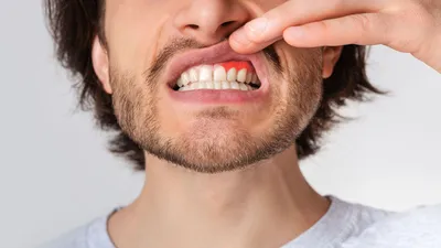 Фото зубов Зубов: когда здоровье важнее всего