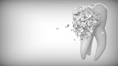 Фото здоровых зубов: как избежать кариеса и других проблем