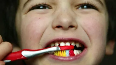 Молочные зубы у детей: схема выпадения, сроки, фото | Dental Art