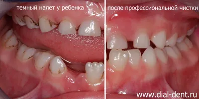 Детский рот с зубами рисунок (45 фото) » рисунки для срисовки на  Газ-квас.ком